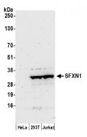 Detection of human SFXN1 by western blot