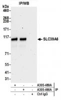 Detection of human SLC39A6 by western bl