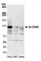 Detection of human SLC39A6 by western bl
