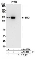 Detection of human SMC1 by western blot 