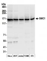 Detection of human and mouse SMC1 by wes