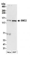 Detection of human SMC2 by western blot.