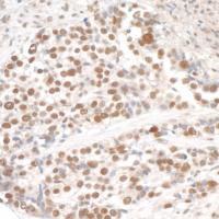 Detection of human SMC3 by immunohistoch