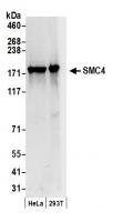 Detection of human SMC4 by western blot.