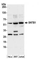 Detection of human SNTB1 by western blot