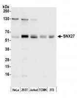 Detection of human and mouse SNX27 by we