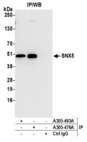 Detection of human SNX5 by western blot 
