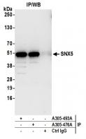 Detection of human SNX5 by western blot 