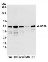 Detection of human and mouse SNX5 by wes