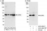 Detection of human SORD by western blot 