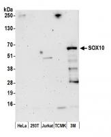 Detection of human and mouse SOX10 by we
