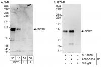Detection of human SOX6 by western blot 