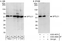 Detection of human and mouse SPTLC1 by w