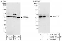 Detection of human SPTLC1 by western blo