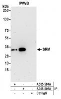 Detection of human SRM by western blot o