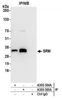 Detection of human SRM by western blot o