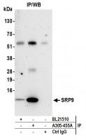 Detection of human SRP9 by western blot 