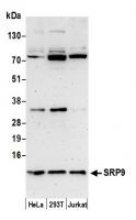 Detection of human SRP9 by western blot.