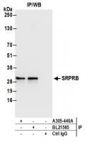 Detection of human SRPRB by western blot