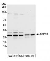 Detection of human and mouse SRPRB by we