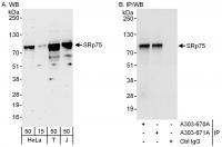 Detection of human SRp75 by western blot