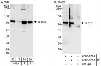 Detection of human SRp75 by western blot