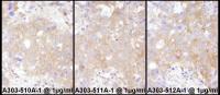Detection of human STAT2 by immunohistoc