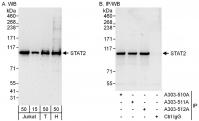 Detection of human STAT2 by western blot