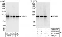 Detection of human STAT2 by western blot