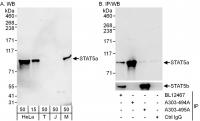 Detection of human and mouse STAT5a by w