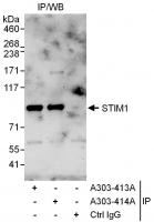 Detection of human STIM1 by western blot
