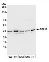 Detection of human and mouse STX12 by we