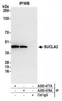 Detection of human SUCLA2 by western blo