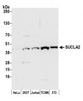Detection of human and mouse SUCLA2 by w
