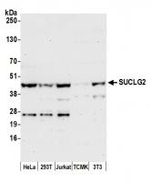 Detection of human and mouse SUCLG2 by w