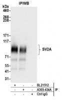 Detection of human SV2A by western blot 