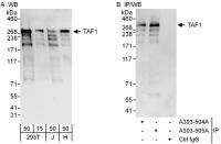 Detection of human TAF1 by western blot 
