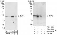 Detection of human TAF5 by western blot 