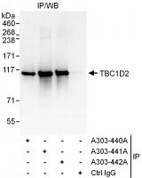 Detection of human TBC1D2 by western blo