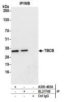 Detection of human TBCB by western blot 