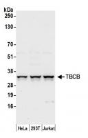 Detection of human TBCB by western blot.