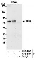Detection of human TBCE by western blot 