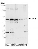 Detection of human and mouse TBCE by wes