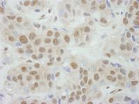 Detection of human TBP1 by immunohistoch