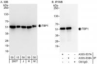 Detection of human and mouse TBP1 by wes