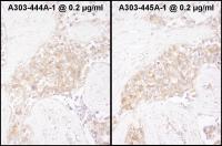 Detection of human TCP1 by immunohistoch