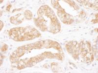 Detection of human TCP1 by immunohistoch