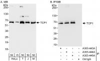 Detection of human and mouse TCP1 by wes