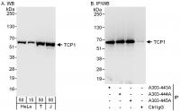 Detection of human TCP1 by western blot 