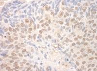 Detection of human TDRD3 by immunohistoc